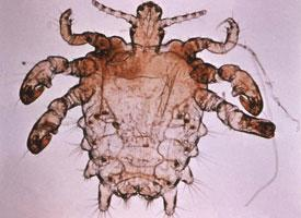 Fotó: Crab louse